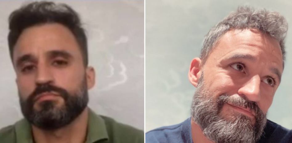 Un enfermero impacta en Twitter por el gran deterioro físico que ha sufrido durante la pandemia