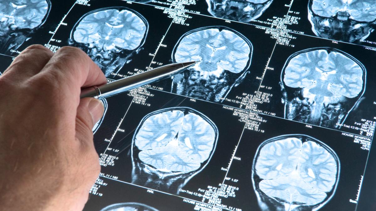 Durante el embarazo, las mujeres experimentan cambios en el 94% de la materia gris del cerebro